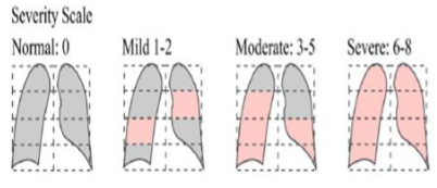 Severity RALE Score [9]